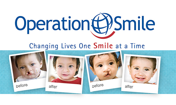 Operation Smile Pictures 44